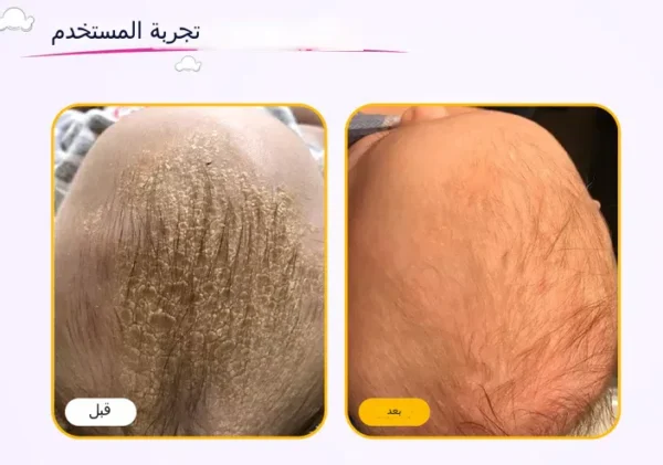 ⁦شامبو كلينيكيد العضوي 100% لحديثي الولادة من كلينيكيد 250 مل Clinikid⁩ - الصورة ⁦2⁩